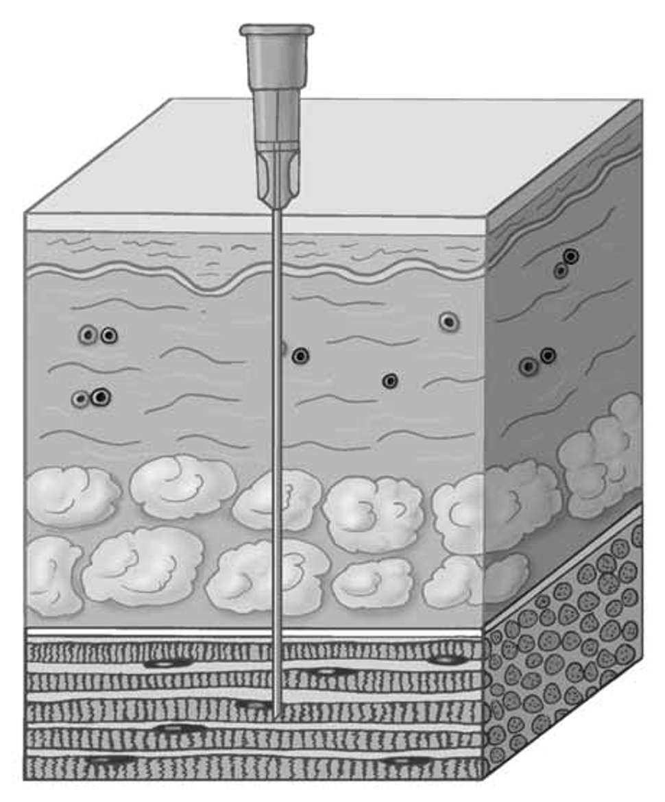 vaksinasjonsboka figur 1.jpg