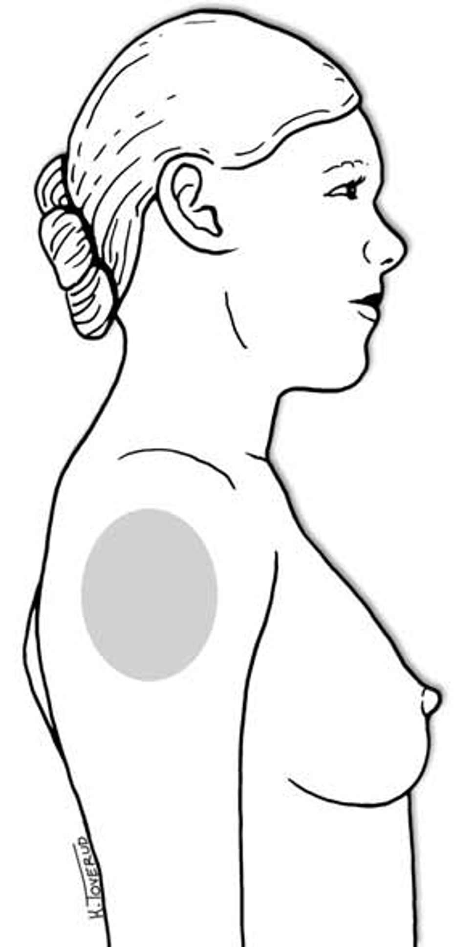 vaksineboka figur 2b.jpg